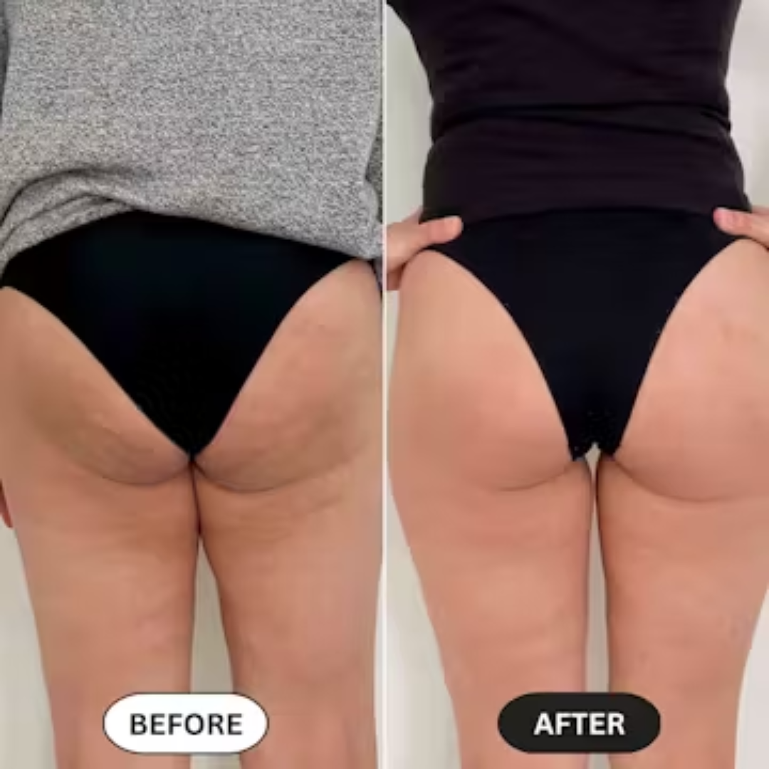 Anti-Cellulite Massage Oil™