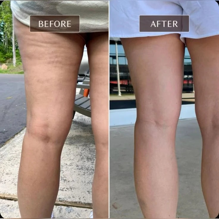 Anti-Cellulite Massage Oil™