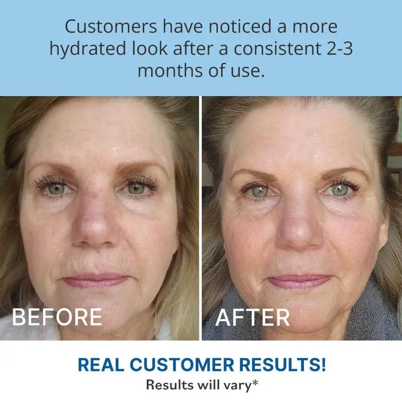 Anti Wrinkle Moisturizer