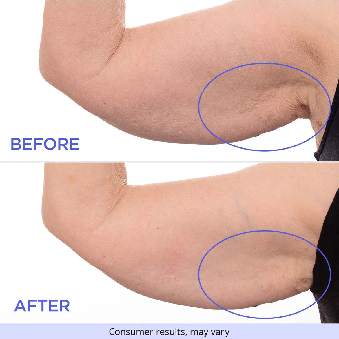 Arm Tightening & Lift Cream™