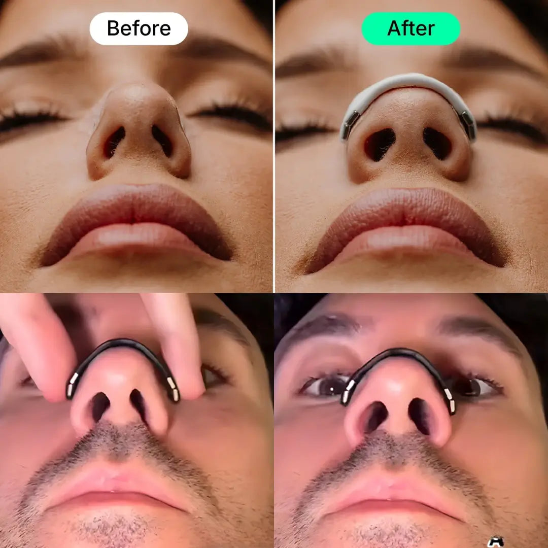 Magnetic Nasal Strip