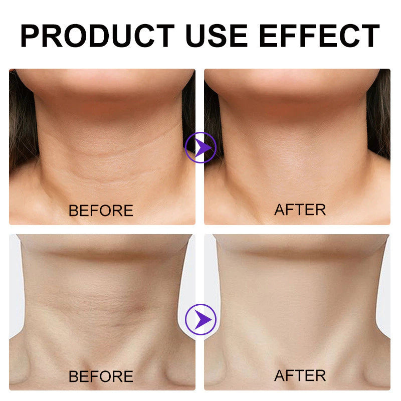 Neck Tightening & Lift Cream