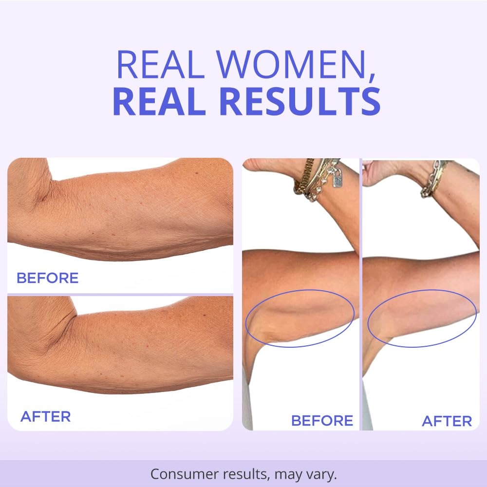 Arm Tightening & Lift Cream™