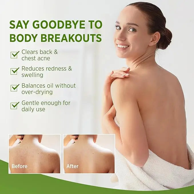 Tea Tree Oil™ Antifungal Soap