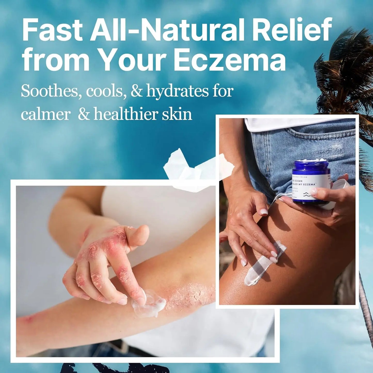 Eczema Soothing Cream