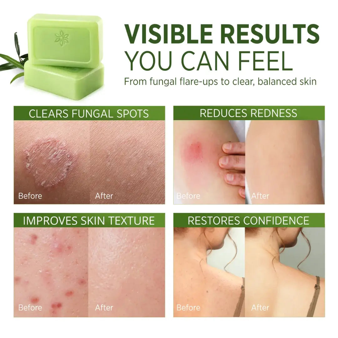 Tea Tree Oil™ Antifungal Soap