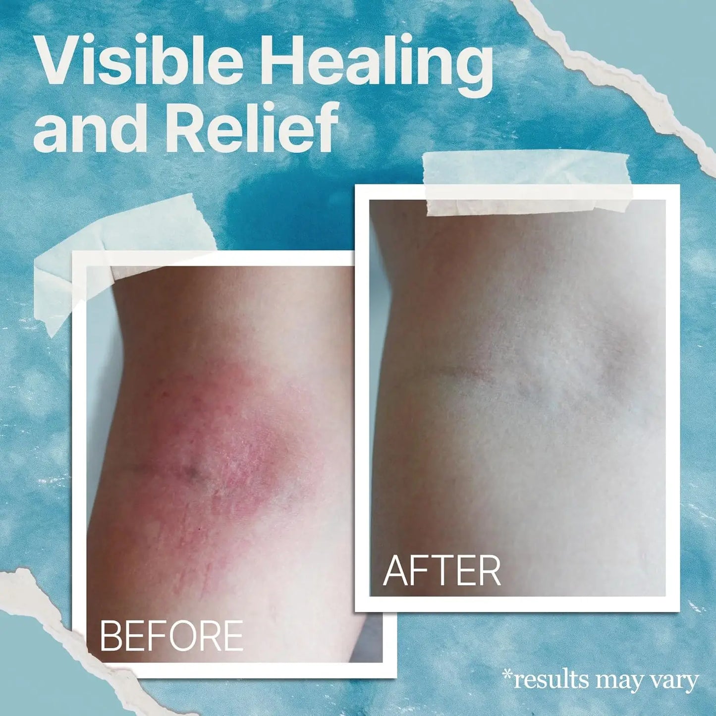 Eczema Soothing Cream