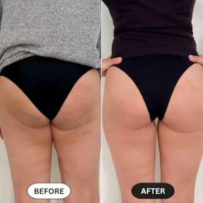 Anti-Cellulite Massage Oil™