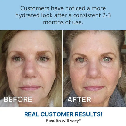 Anti Wrinkle Moisturizer