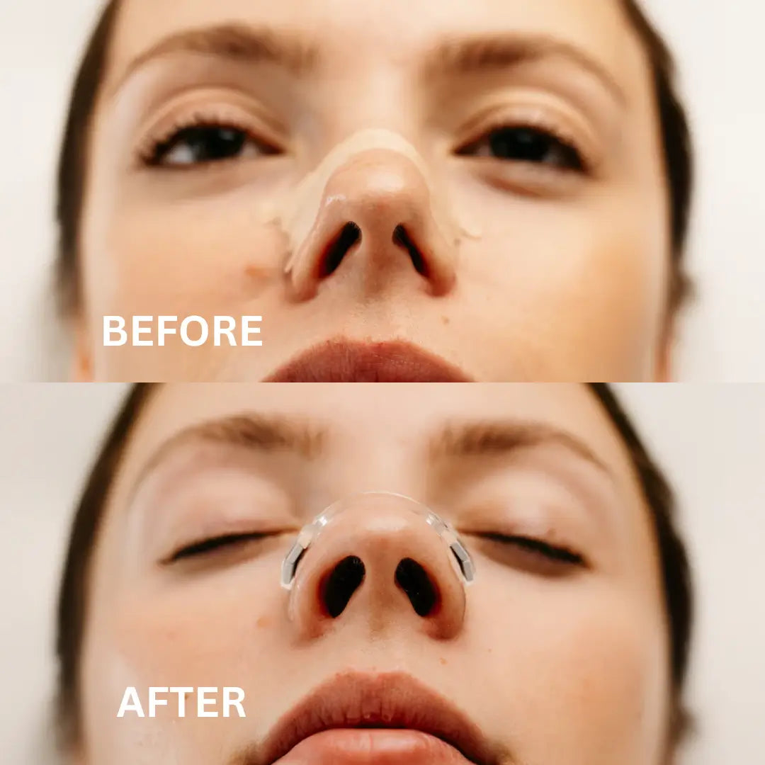 Magnetic Nasal Strip
