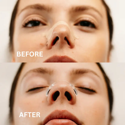 Magnetic Nasal Strip