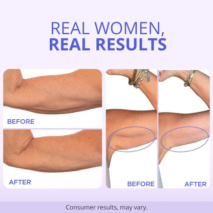 Arm Tightening & Lift Cream™