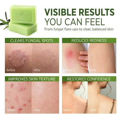 Tea Tree Oil™ Antifungal Soap