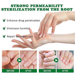 Antifungal Nail Treatment Serum