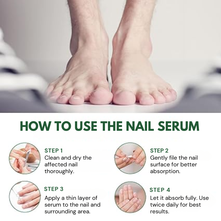 Antifungal Nail Treatment Serum